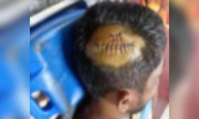নোয়াখালীতে কুড়ালের কোপে কৃষকের মৃত্যু!
