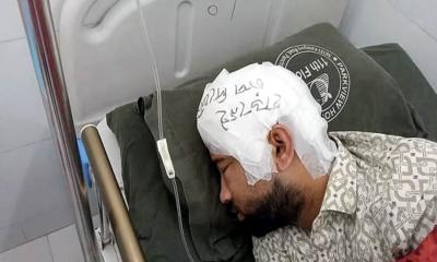 ‘মাথার খুলি ফ্রিজে, কেউ চাপ দেবেন না’