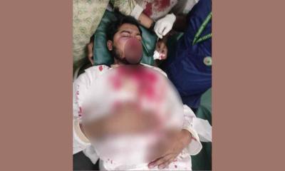জাপা কার্যালয়ের সামনে ফের সংঘর্ষ, গুরুতর আহত নুরুল হক নুর