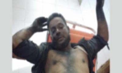 সীতাকুন্ডে গ্যাস বিস্ফোরণে শ্রমিক আহত