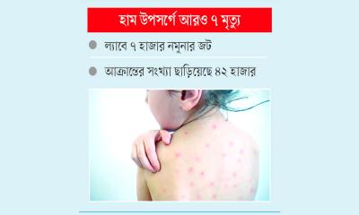 কিট স্বল্পতায় হামের ভয়াল রূপ