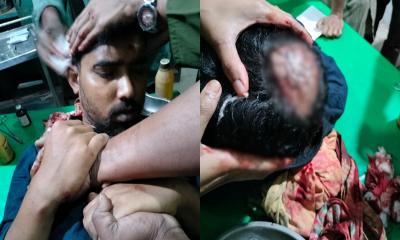 শালিখায় আধিপত্য বিস্তার নিয়ে দুই গ্রুপের সংঘর্ষ, গুরুতর আহত ১