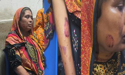 বউয়ের মায়ের কামড়ে হাসপাতালে ভর্তি স্বামীর মা