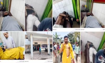 আড়াইহাজারে জামায়াত প্রার্থীর গণসংযোগে হামলা, শিবির সভাপতিসহ আহত ১০