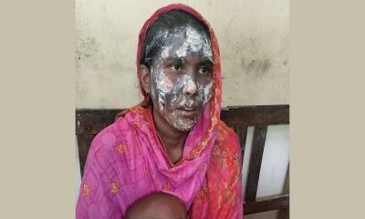 পীরগঞ্জে স্বামীর পরকীয়ার জের ধরে স্ত্রীর মুখ পুড়িয়ে দিলেন স্বামী