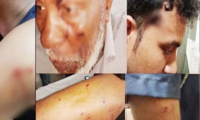 সন্ত্রাসীদের হামলায় ওসিসহ ৫ পুলিশ সদস্য গুলিবিদ্ধ