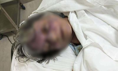 রাজধানীতে বিদেশি নাগরিককে পিটিয়ে হত্যার অভিযোগ