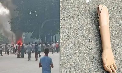 পুলিশের সঙ্গে সংঘর্ষ: রাস্তায় পড়েছিল জুলাই যোদ্ধার কৃত্রিম হাত