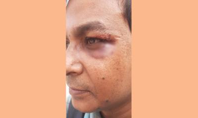 সাংবাদিক মুরাদের ওপর হামলা, ডিআরইউয়ের নিন্দা ও প্রতিবাদ