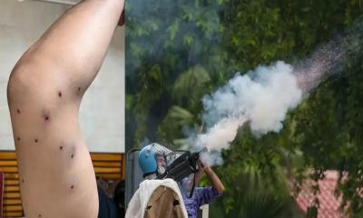 আন্দোলনকারীদের শরীরে ছররা গুলির আঘাত, পুলিশের অস্বীকার
