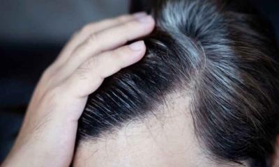যেসব কারণে অল্প বয়সেই চুল পেকে যায়