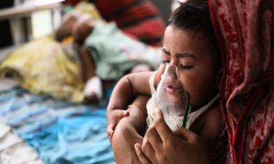 হামের উপসর্গে আরও এক শিশুর মৃত্যু
