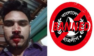 নিষিদ্ধ ছাত্রলীগের হামলায় ডিআইইউ ছাত্রনেতা আহত